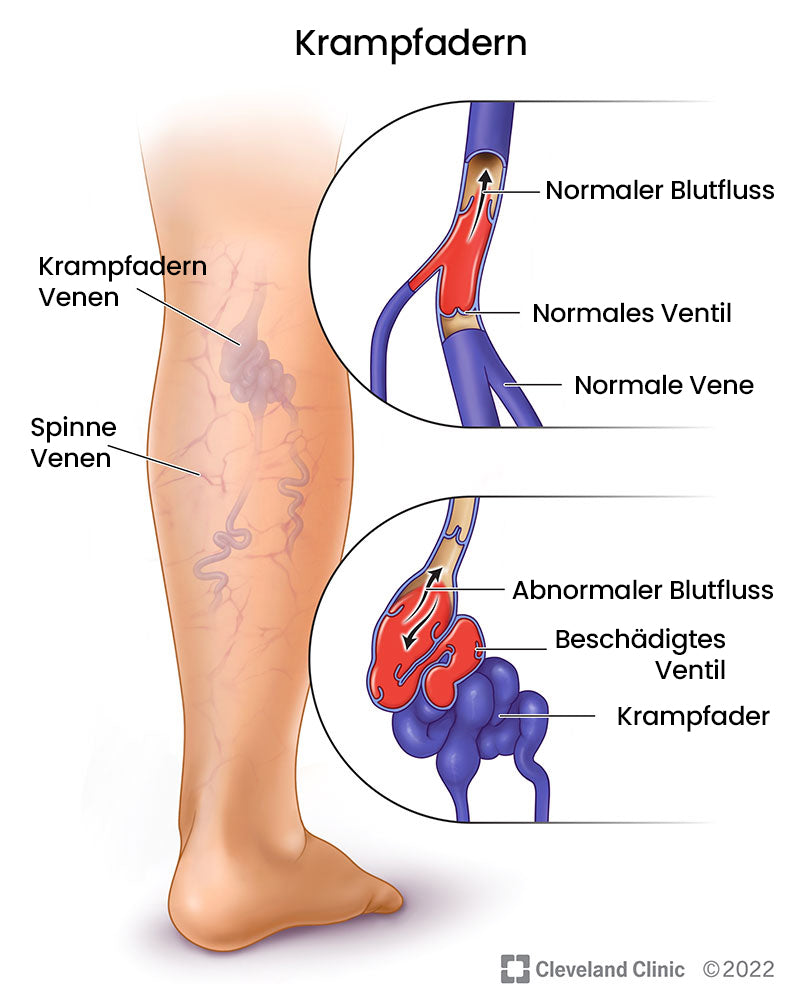 Raura™ Krampfader-Creme