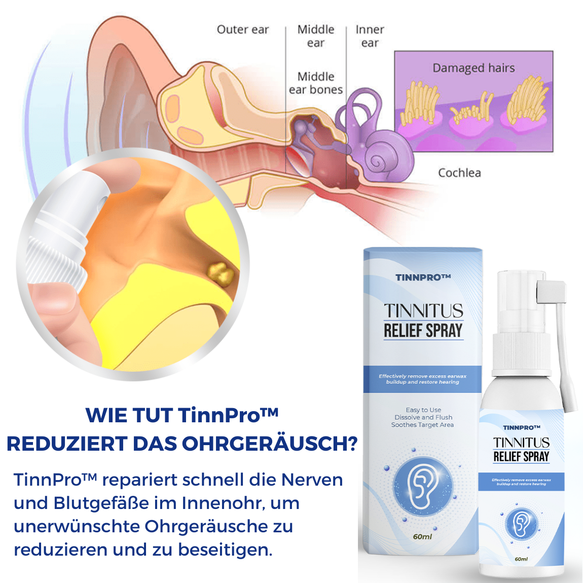 TinnPro™️ Tinnitus Linderungsspray👂