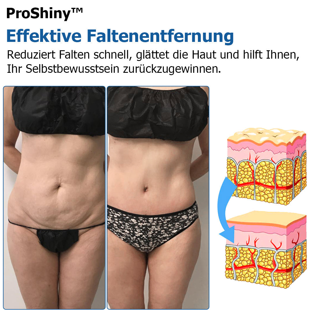 Letzter Tag 50% Rabatt🎁ProShiny™ Kompression Körperformung Set